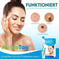 AutoTag™ Schnelle & schmerzlose Entfernung von Hautmarkierungen