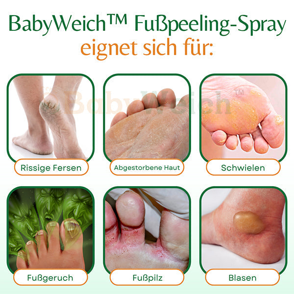 Erhalten Sie 2 Packungen BabyWeich™ Fußpeeling-Spray mit 75% Rabatt!