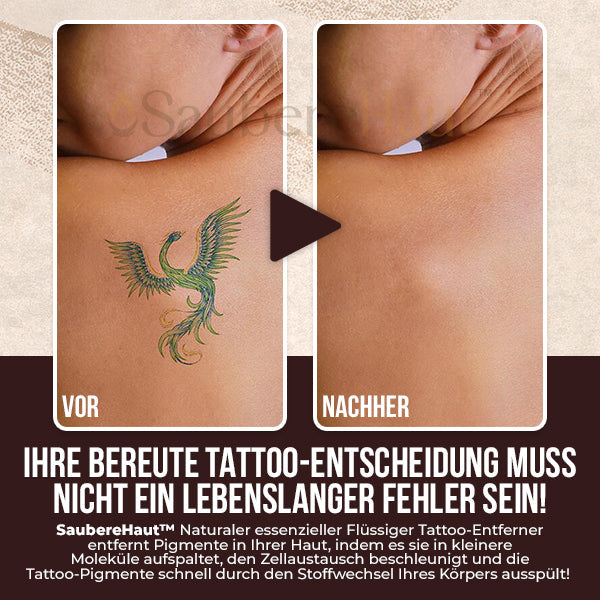 Wie wäre es mit nur noch 1 Stück SaubereHaut™ Naturaler essenzieller Flüssiger Tattoo-Entferner für NUR €9,99?
