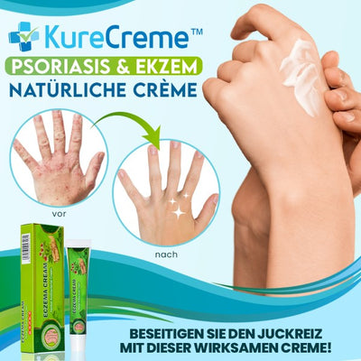 Erhalten Sie 2 KureCreme™ Psoriasis & Ekzem Natürliche Crème mit 75% Rabatt