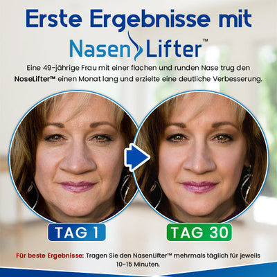 Wie wäre es mit 1 Stück von NasenLifter™ Nasenschlankheitsklammer für NUR €9,99?