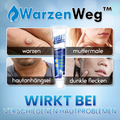 WarzenWeg™ Hautunreinheiten-Creme