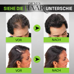 Erhalten Sie 3x DickesHaar™ Sofort-Haarverdichter für 70% Rabatt!