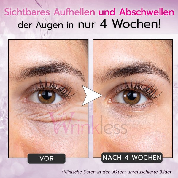 Erhalten Sie 2 Stück Wrinkless™ Kollagen-Peptid-Augencreme mit 75% Rabatt!